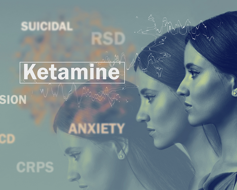 ketamine-for-anxiety